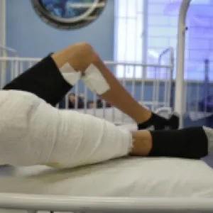 Reportan cerca de 500 quemados por pólvora en Colombia: hay preocupación por disponibilidad de camas