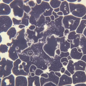 Descubren mecanismos naturales de defensa contra el cáncer